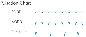 pulsation chart 300x130 1 by CDR Pumps